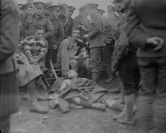 A black-and-white photograph of injured rugby players. One player sits on a chair and has a head injury treated. A second player lies on the ground covered by a blanket. Spectators stand close to the players on the sideline. 